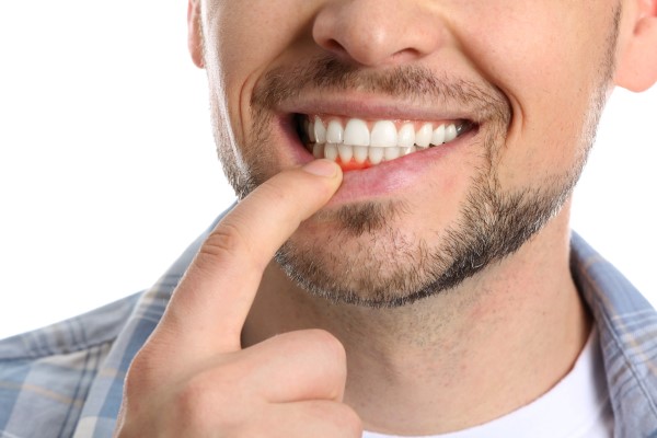 What Gum Disease Can Do To Your Oral Health