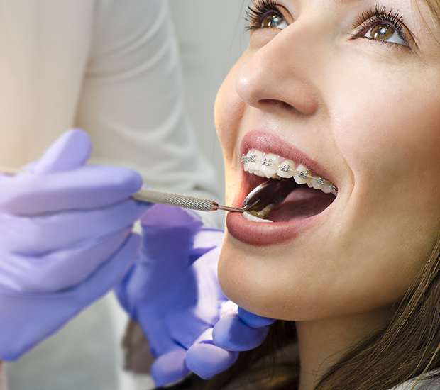 What's Involved in the Dental Bonding Procedure? - Thanasas Family Dental  Care Troy Michigan