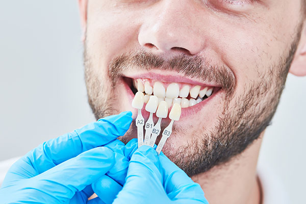 How Are Veneers Replaced? from Thanasas Family Dental Care in Troy, MI