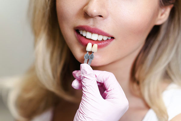 How Effective Are Dental Veneers? from Thanasas Family Dental Care in Troy, MI