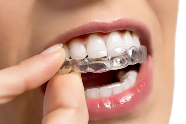 How To Take Care Of Your Teeth With Invisalign