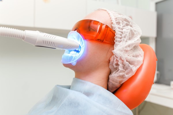 How Laser Teeth Whitening May Affect Tooth Colored Restorations