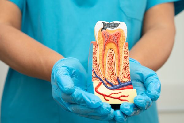 Common Myths About Root Canals, Debunked By Dentists