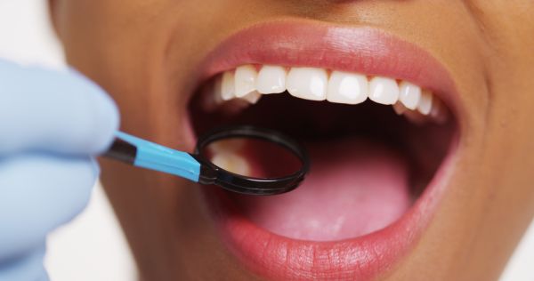 How Mercury Free Dentistry Benefits Your Health
